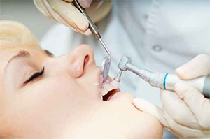 Burbank dentist | teeth cleaning | Dr Ananian